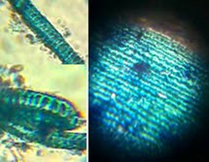 BOTH LIVE AND ANCIENT FOSSILISED DIATOMS FOUND IN TWO METEORITES THAT CRASH LANDED IN SRI LANKA SAYS CHANDRA WICKRAMASINGHE - Figure 2