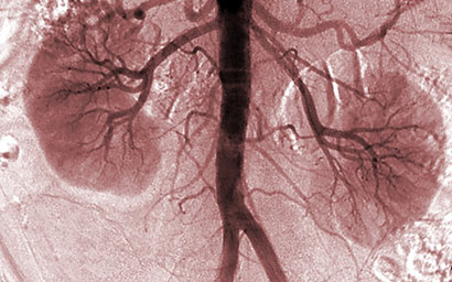 Kidney x-ray