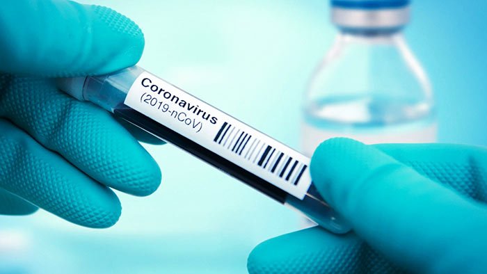 Coronavirus test