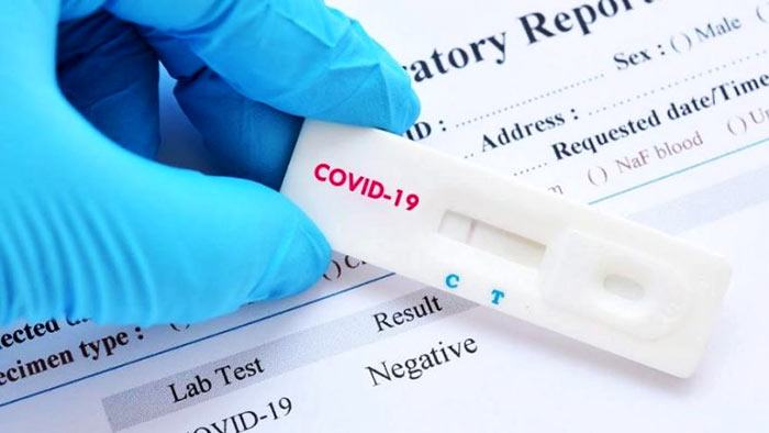 COVID-19 antigen test